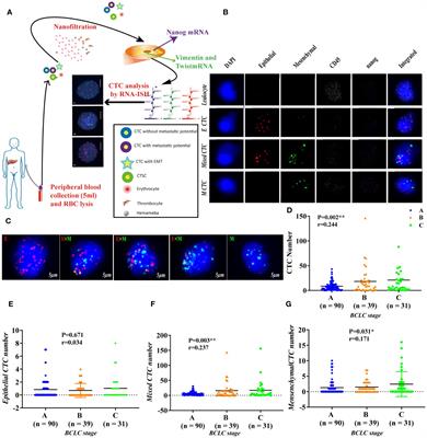 Association of Preoperative NANOG-Positive Circulating Tumor Cell Levels With Recurrence of Hepatocellular Carcinoma